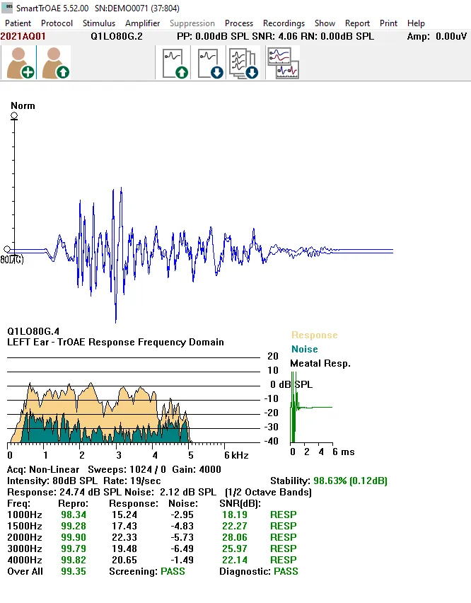 HW180.OP01_SmartTrOAE_Analyse.webp