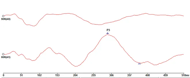 HW180.OP31_P300_Wellenform.webp