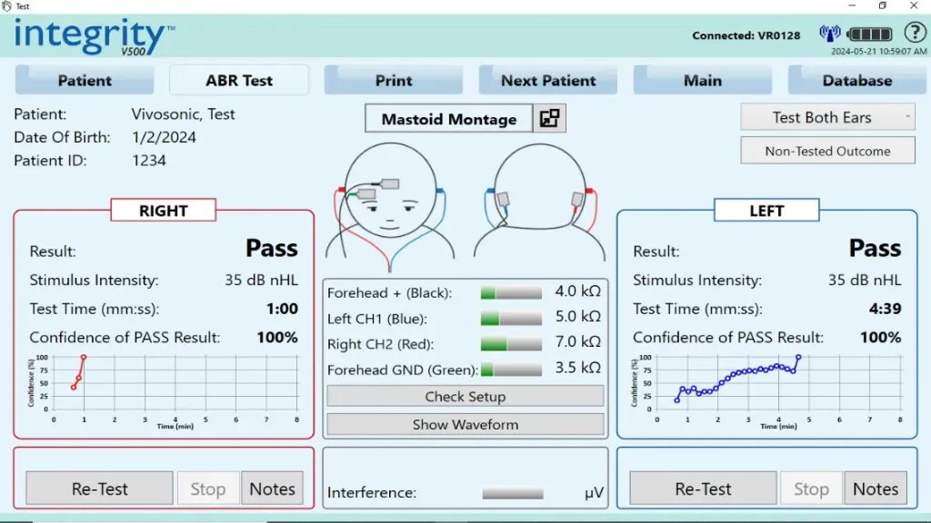 [HW190.OP02] Automated ABR Screening Software License and Hardware Kit