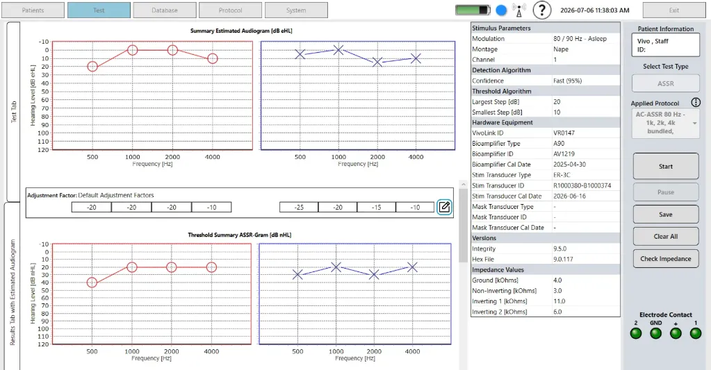 Integrity V500 ASSR License