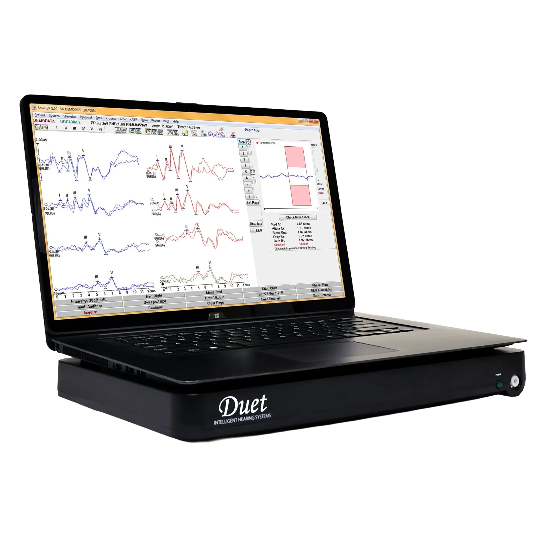 Basismodul Duet 2-Kanal AEP-System